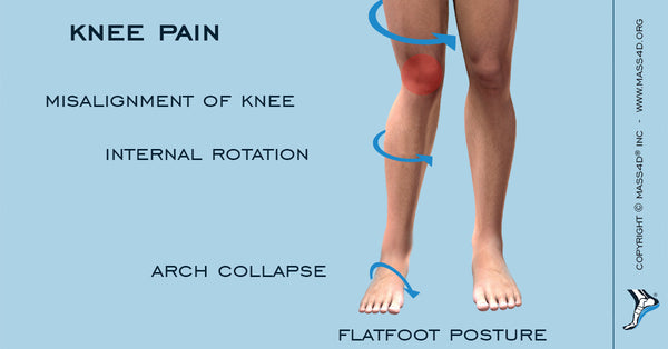 What Causes Knee Pain? | MASS4D 