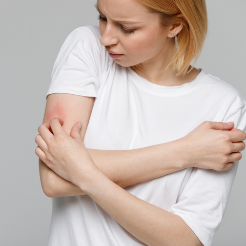 A woman itching her arm