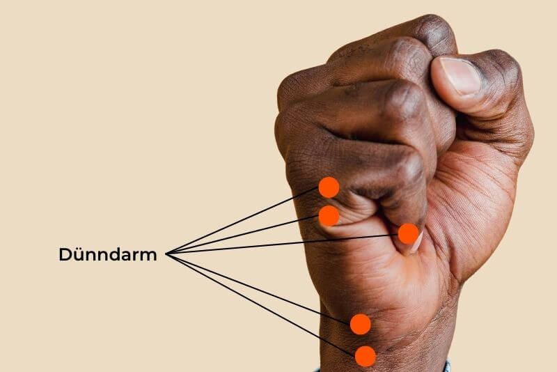 Akupressurpunkte Hand -Fünf orange Punkte zeigen die Punkte 