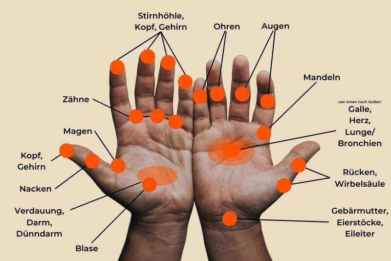 Palms with markings on the corresponding acupressure points