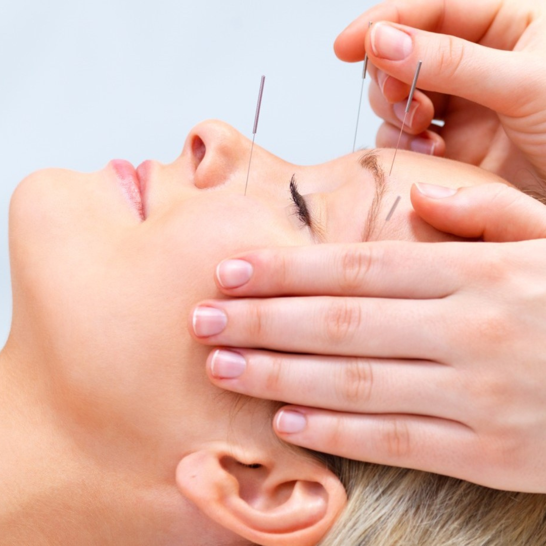 Cosmetic Acupuncture.png__PID:ddc8d2ab-0e10-4b90-9deb-b7d65d6c9265