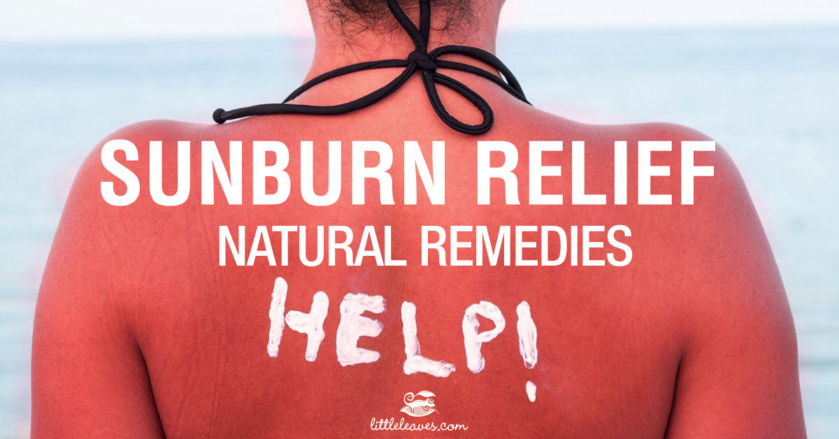 Sunburn Relief Natural Sunburn Remedies