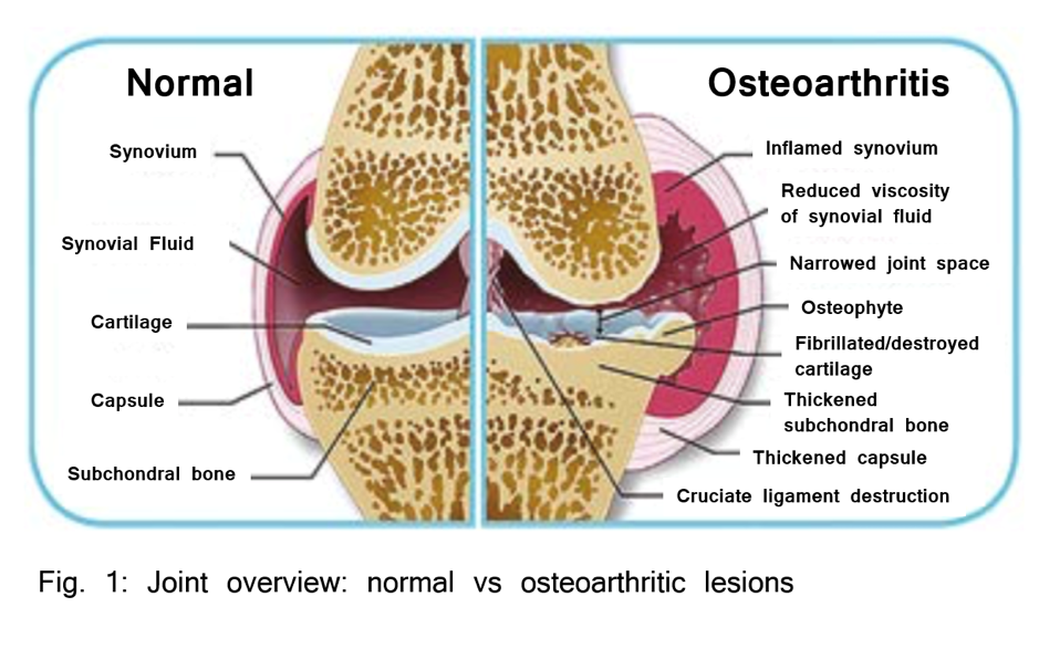 joint cartilage