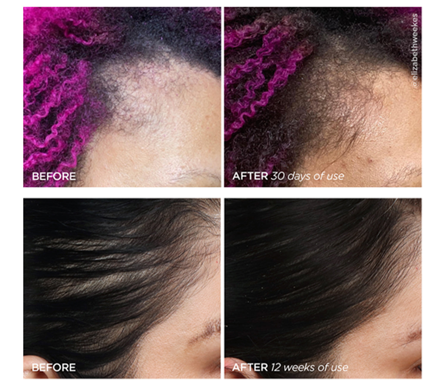 Scalp Before and After Increased Hair Fullness