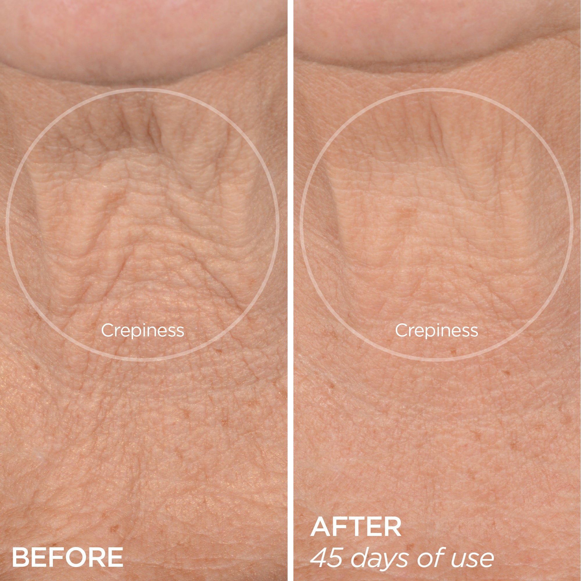 BeautyBio R45 The Lift Neck Contour & Wrinkle Treatment