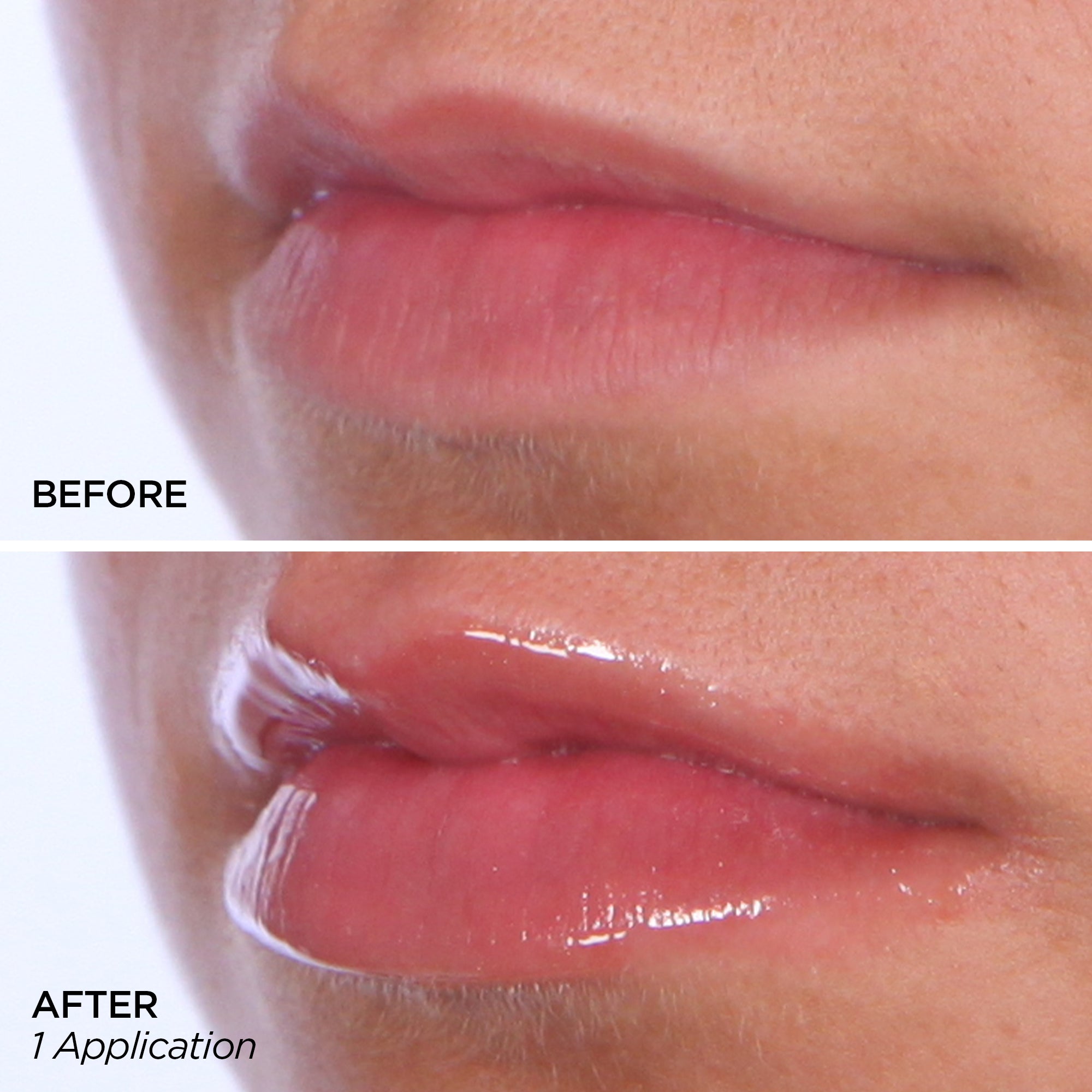 Before & After 1 application of The Pout
