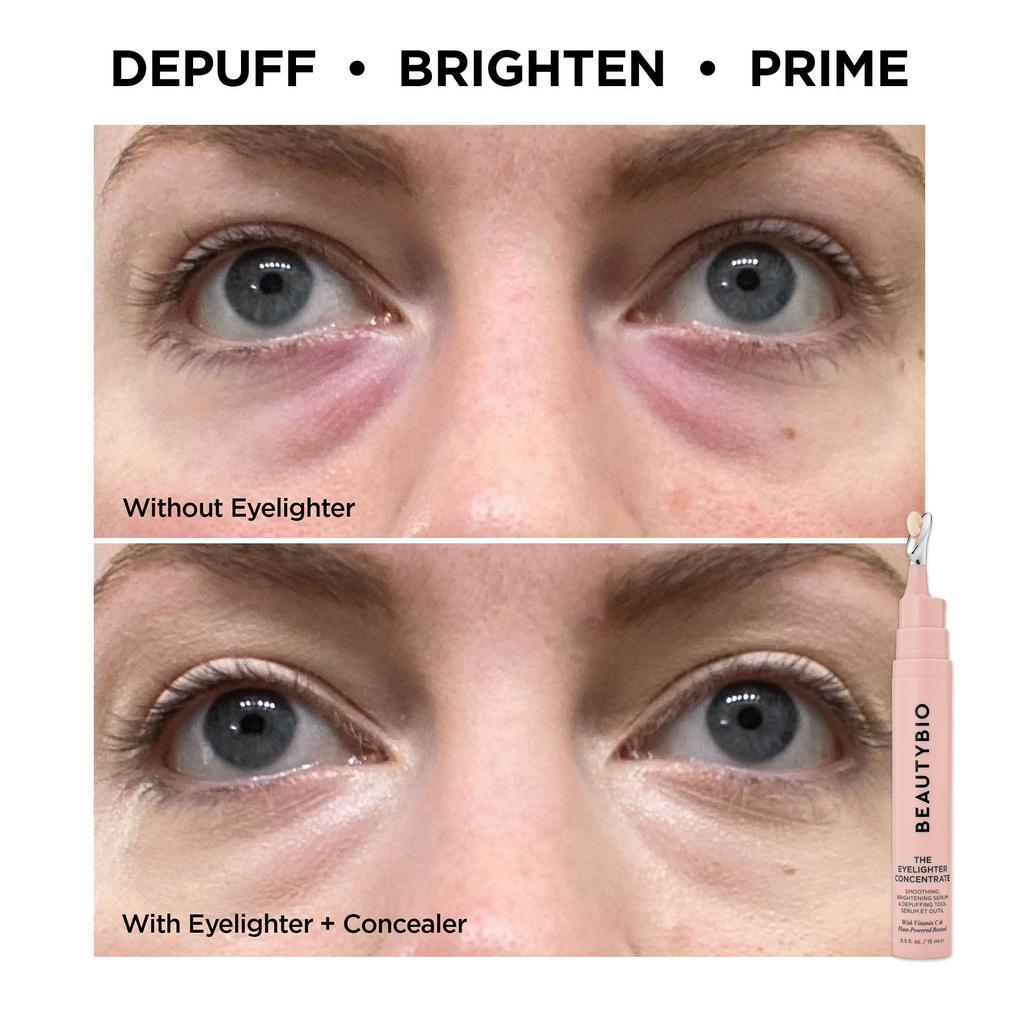 Eyelighter Before & Afters