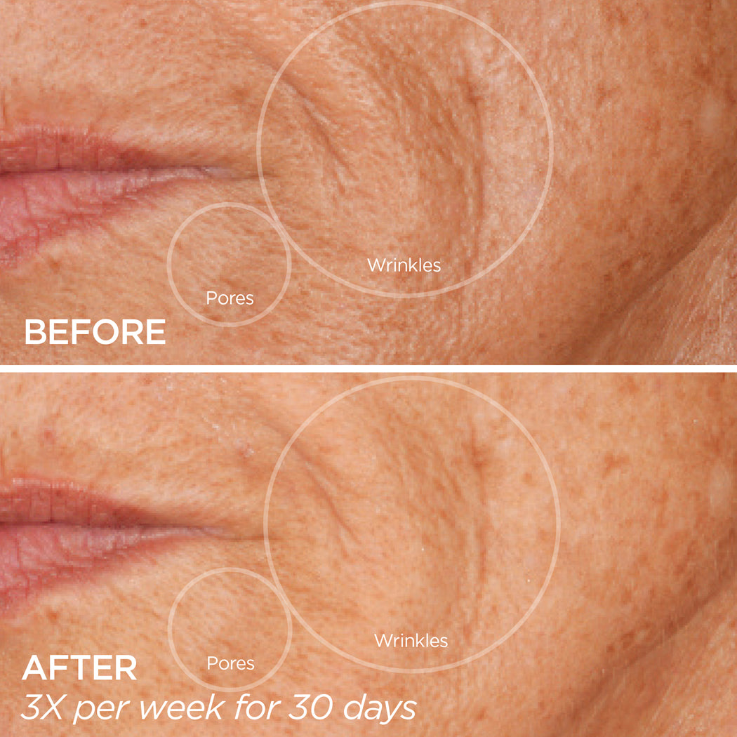 GloPRO Pores and Wrinkles