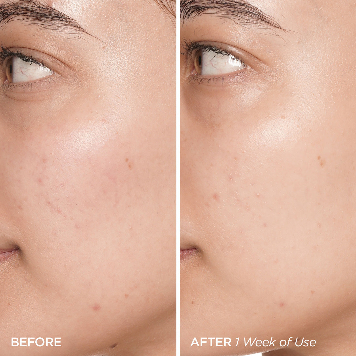 Before and After Image of Swipe & Glow Peel Pads