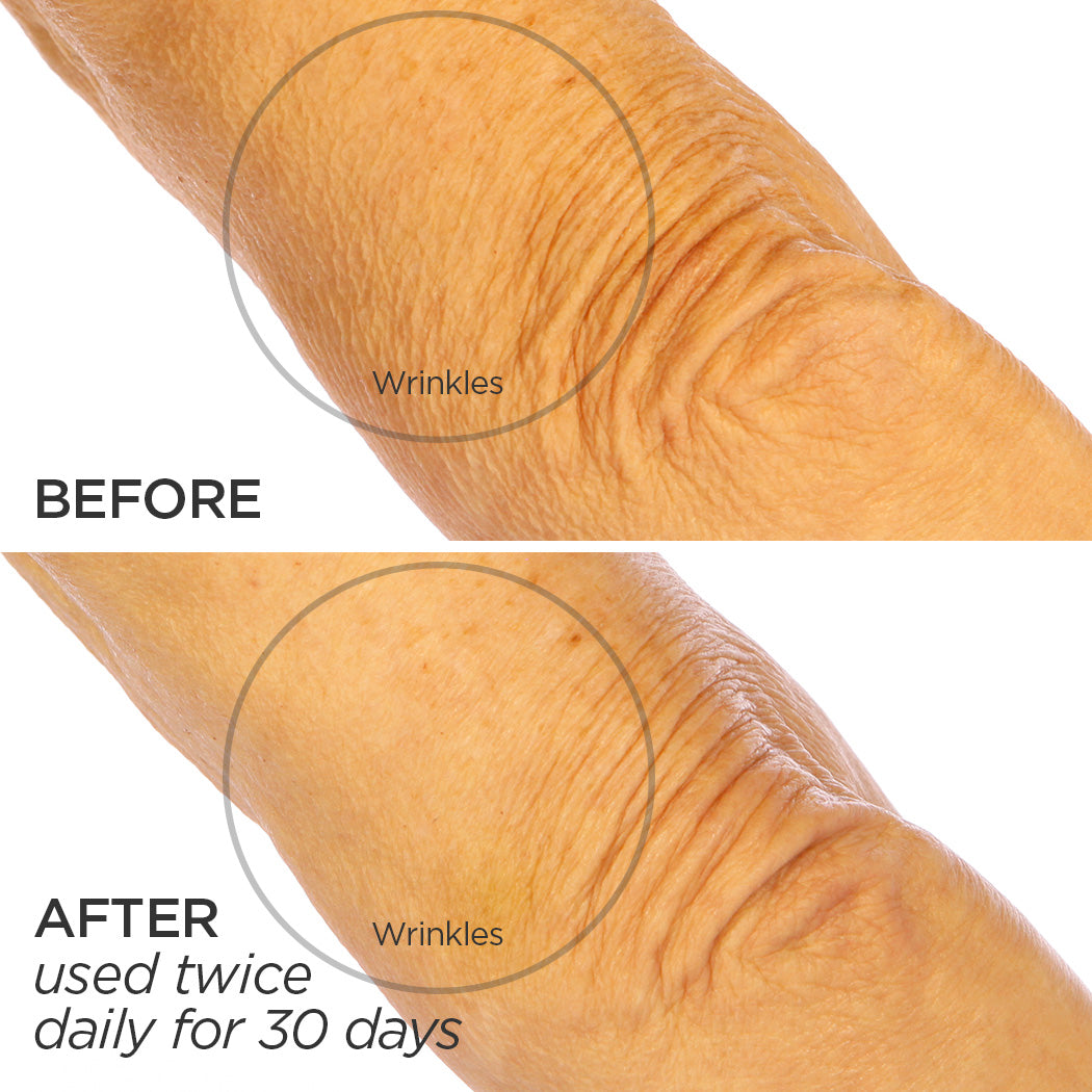Before & After using The Sculptor Skin Firming Body Cream