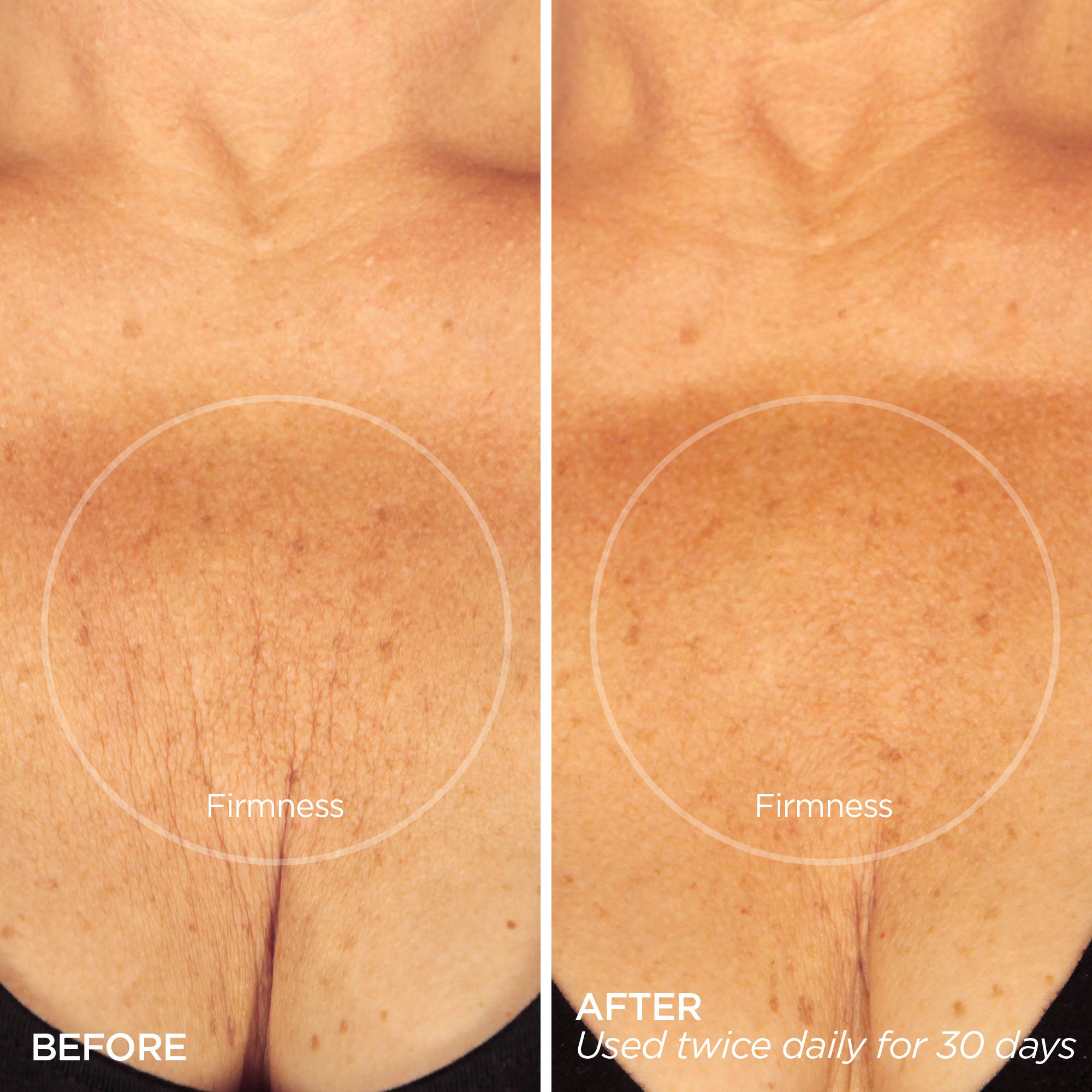 Before & After using The Sculptor Skin Firming Body Cream