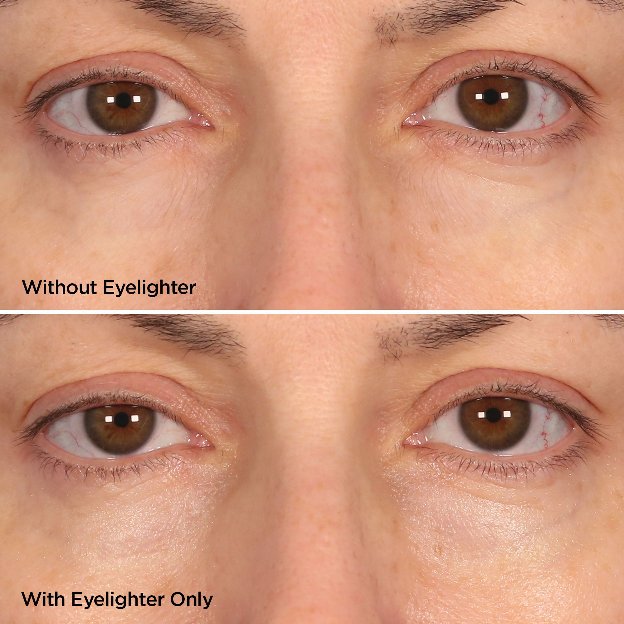 before and after using eyelighter
