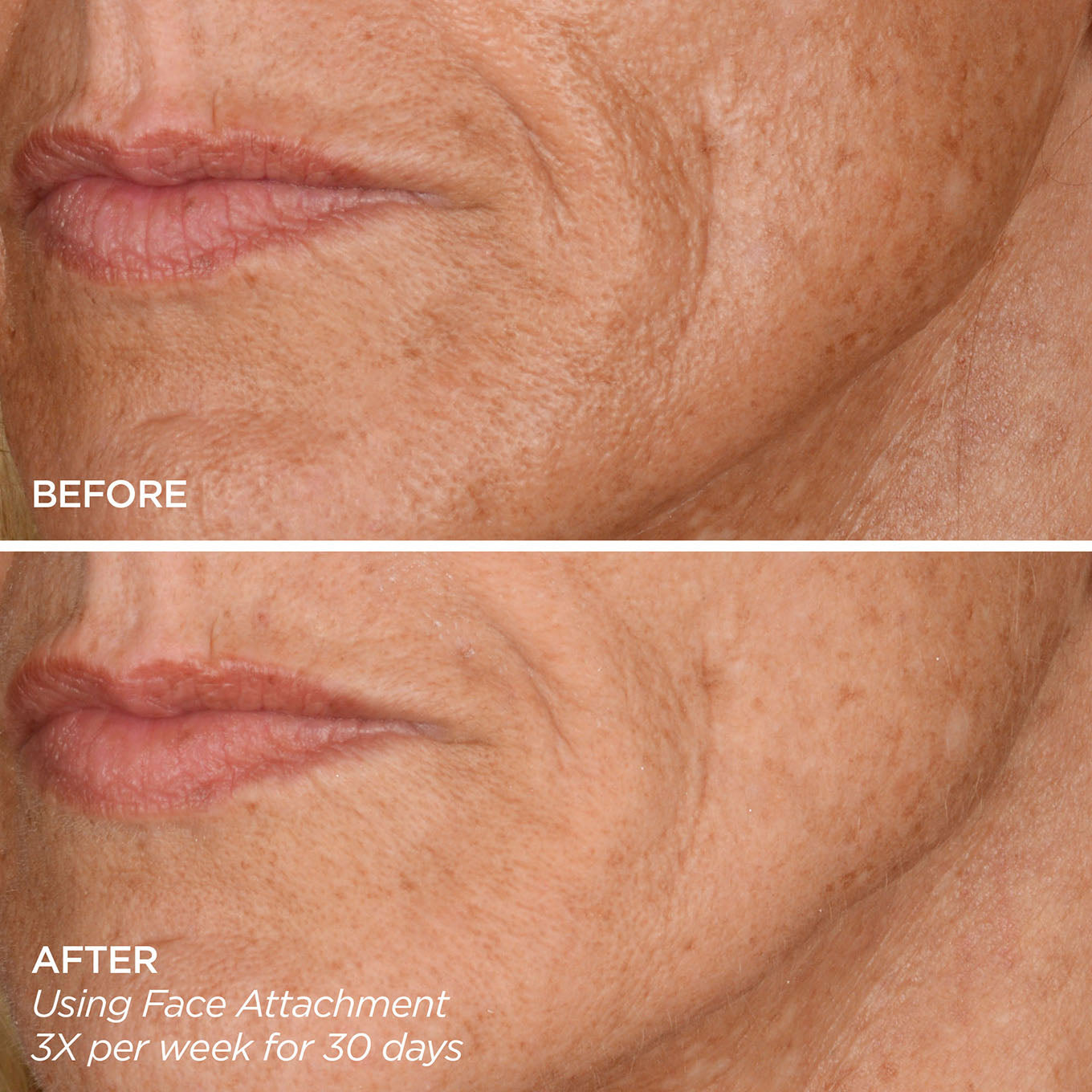 Skincare Wrinkle Reduction