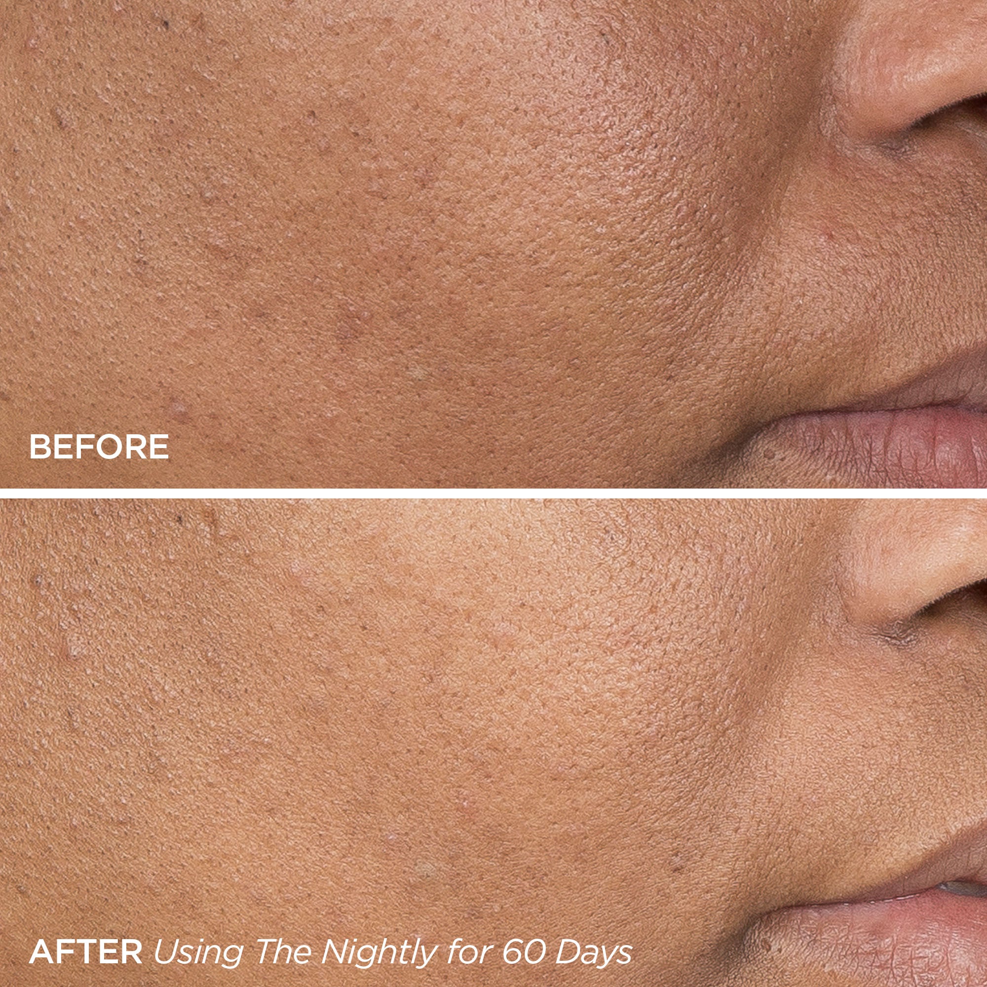 The Nightly Pore Texture Before & After