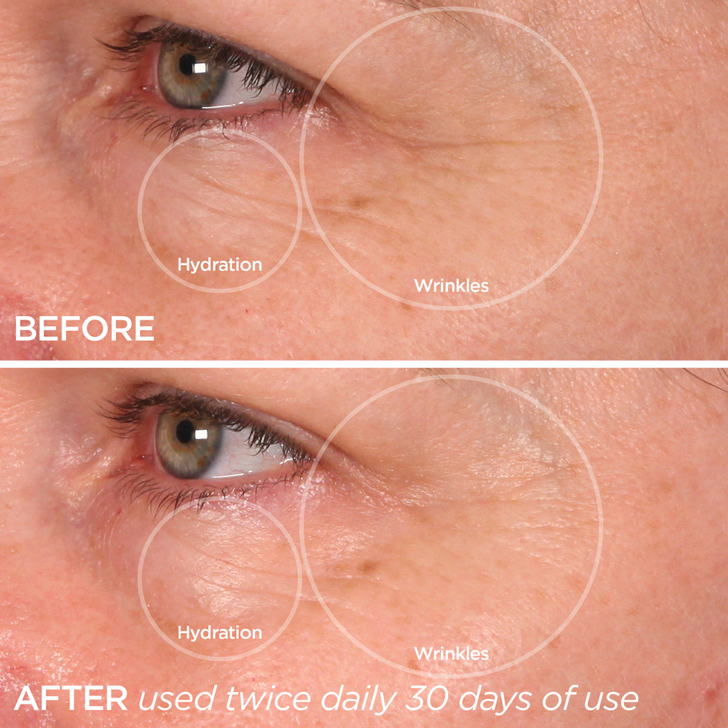 Before & After image using The Quench Eye Balm