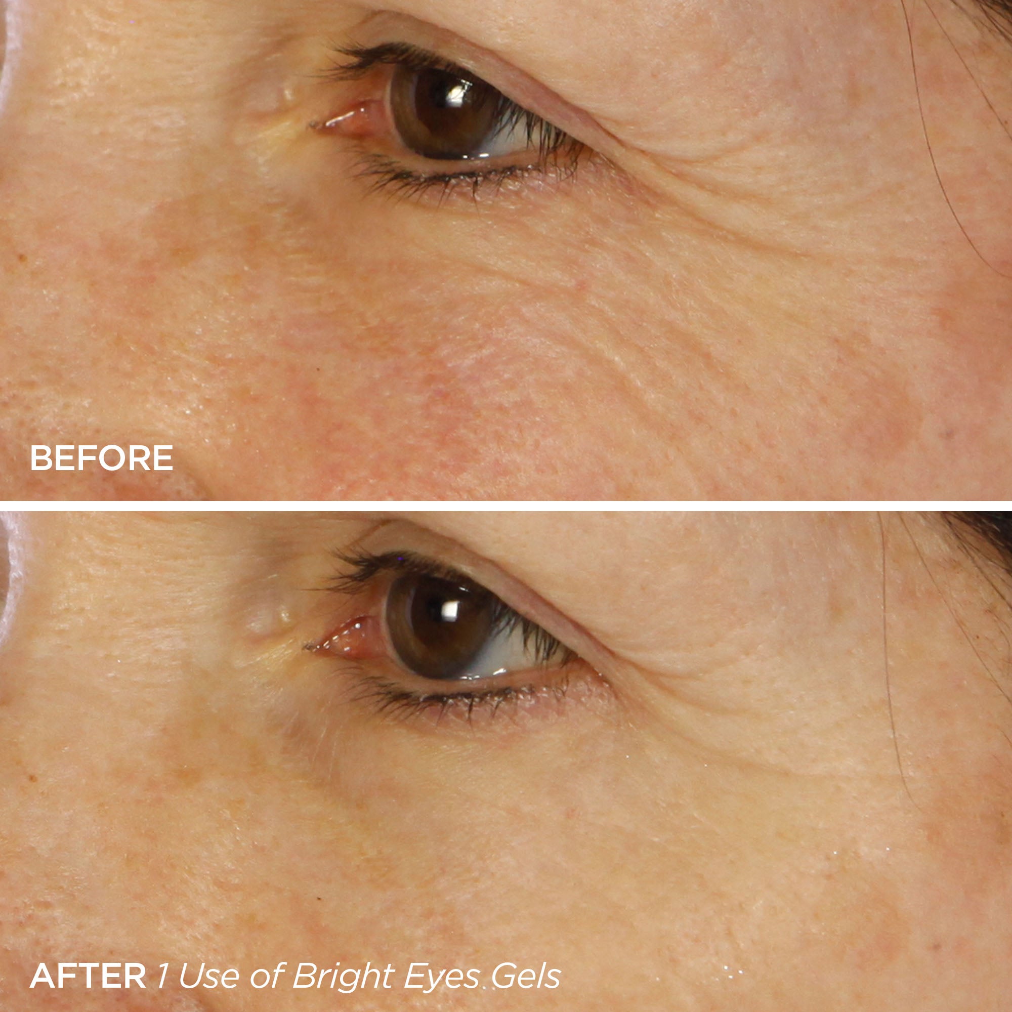 Before & After 1 use of Bright Eyes Gels