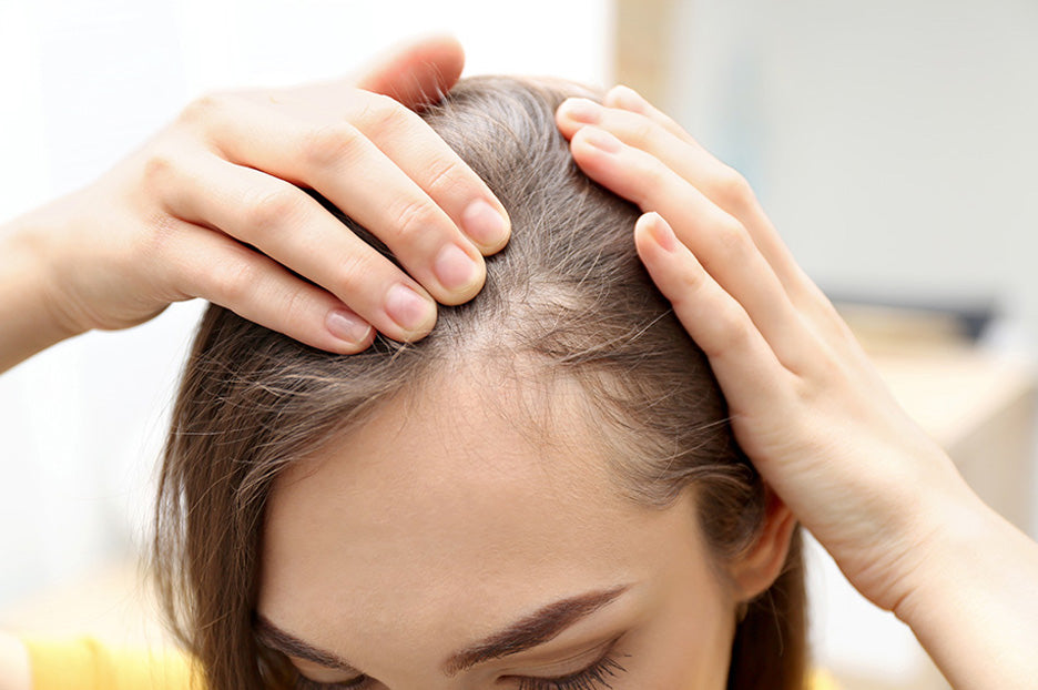Top Hair Loss Prevention Tips in 2018 For Teenagers