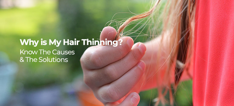 Why is My Hair Thinning? Know The Causes & The Solutions