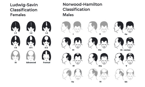 Ludwig-Savin & Norwood Haarlos Chart