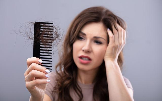 Hair Loss in Woman