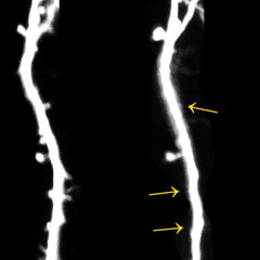 Stress Damages the Movement Centers in the Brain photo credit University of Bonn