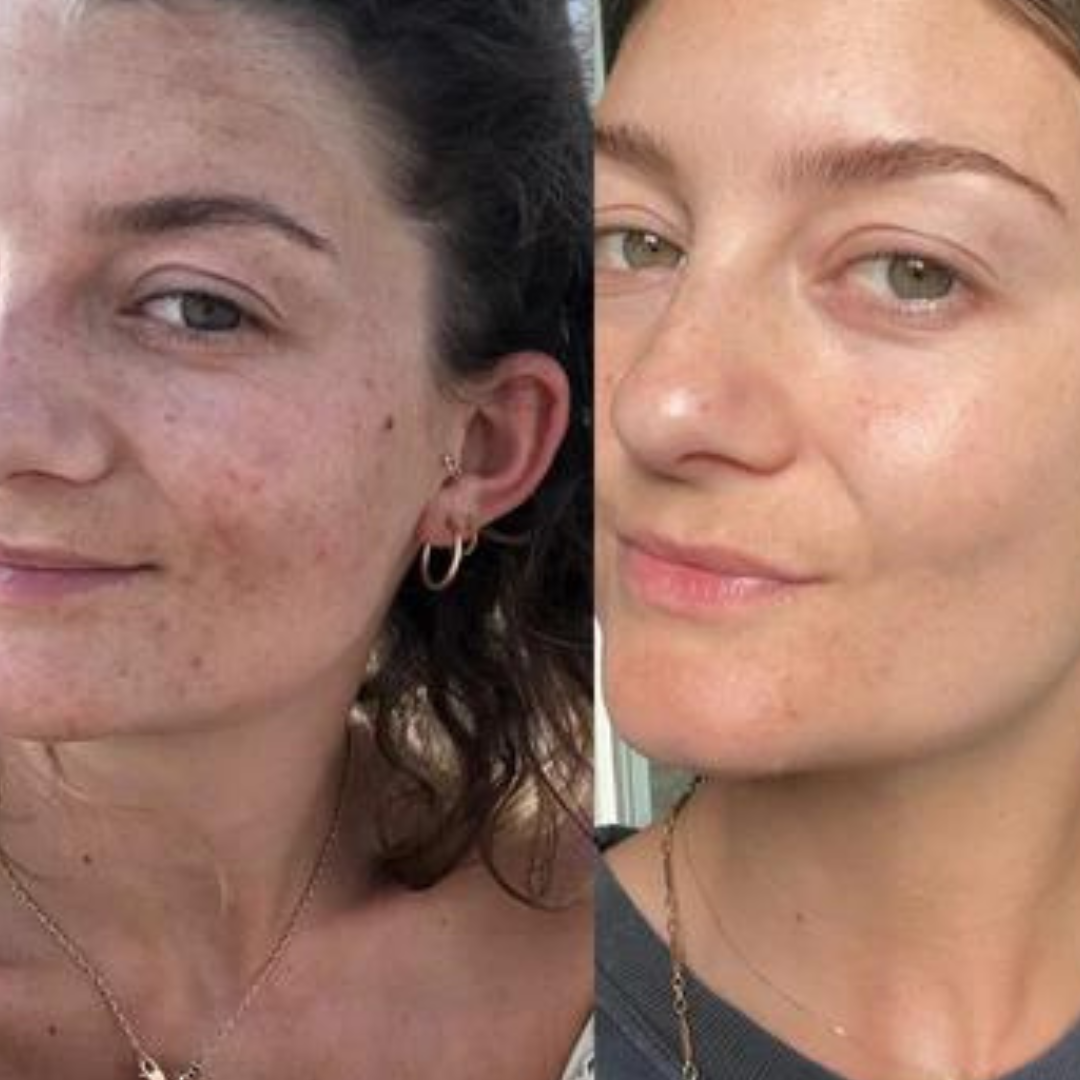 We Tried Vida Glow And Here's What We REALLY Thought Of It