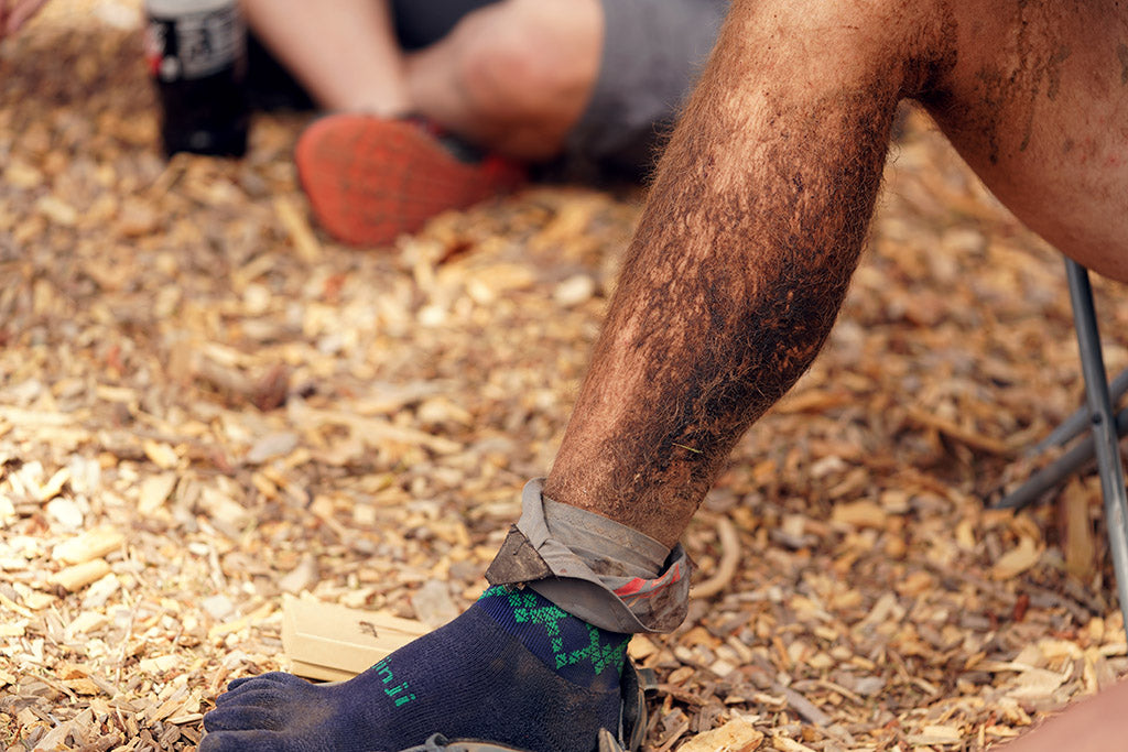 Michael McKnight's legs after finishing the Tahoe 200 mile ultramarathon