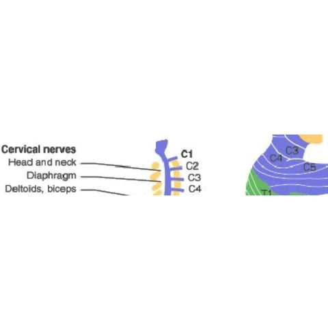 Sci - Lesão da medula espinhal - C4 quadriplegia