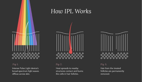 How IPL works