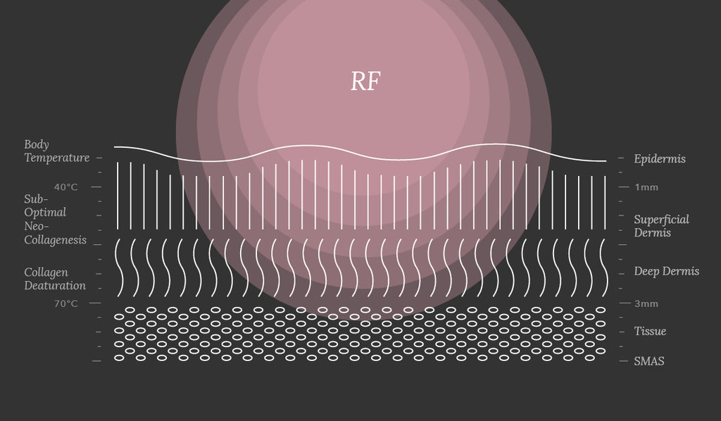 RF-Radio-Frequency