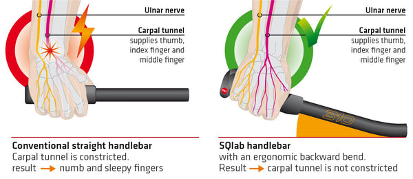 Arm/Handlebar Ergonomics – SQlab