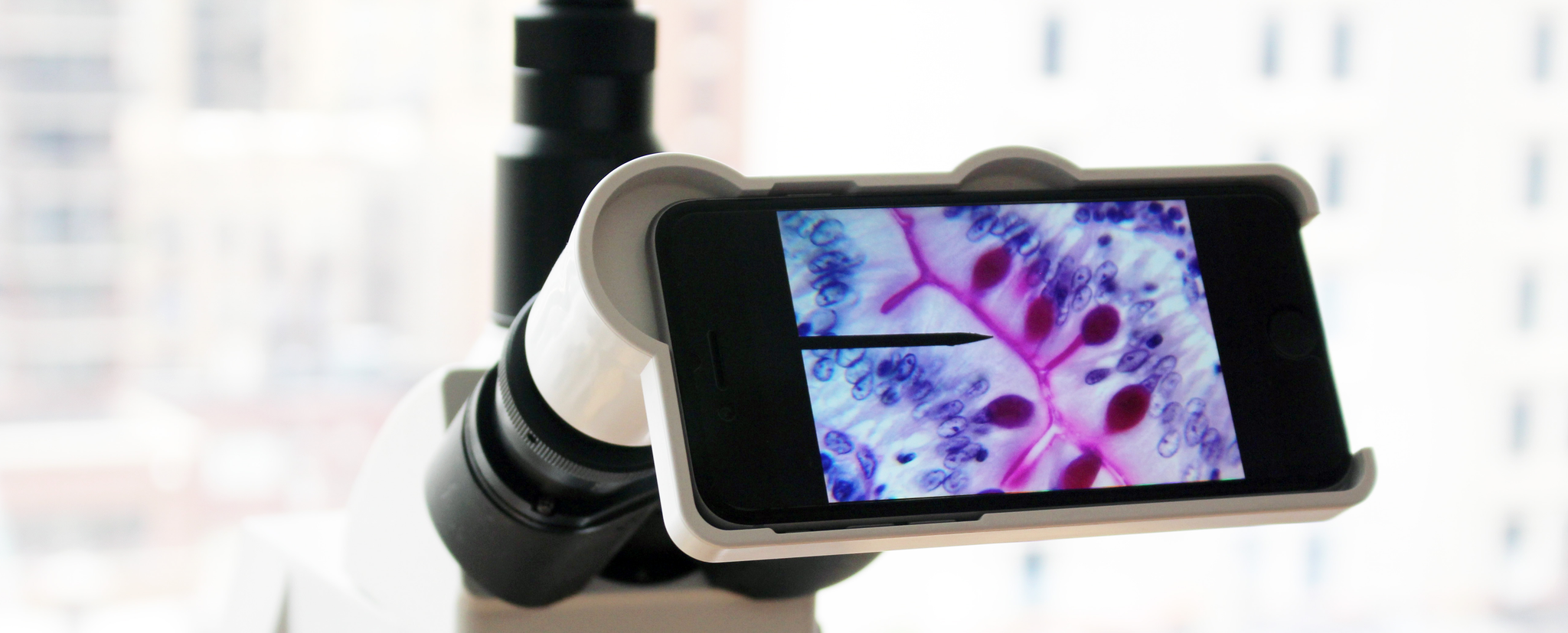Microscope Adapter For Iphone Camera Take High Quality Photographs