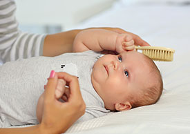 How to Treat Cradle Cap in Babies