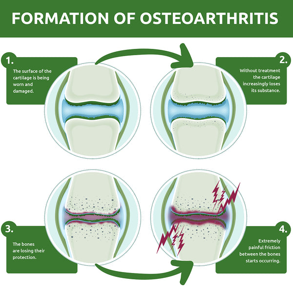 formation of osteoarthritis
