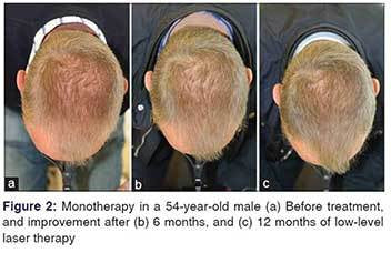 This client is seeing  The Belgravia Hair Loss Centre  Facebook