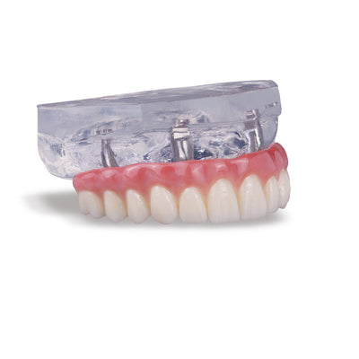 What is BruxZir® Solid Zirconia? Buy from Glidewell Direct - Glidewell