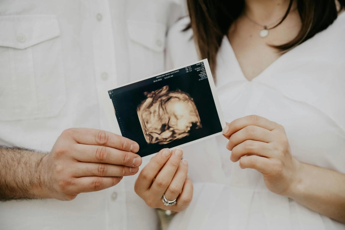 A couple is holding onto the ultrasound picture of their yet-to-be-born baby.