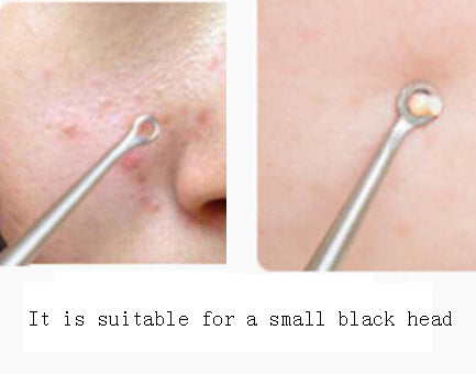 Instructions for using our blackhead extractor set properly!