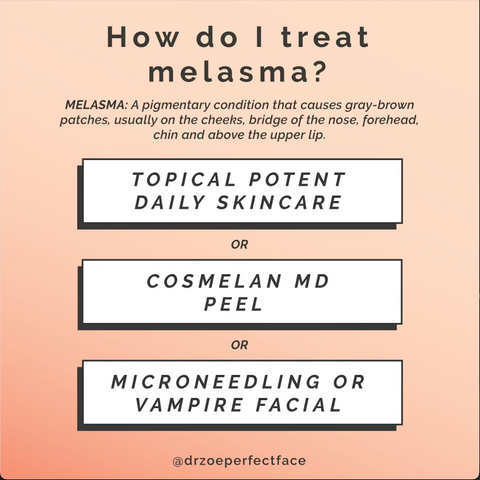 Melasma Treatment Options