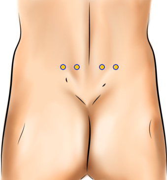 male backside with four yellow dots representing acupressure points