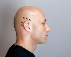 head of a man with black dots along his ears representing acupressure points