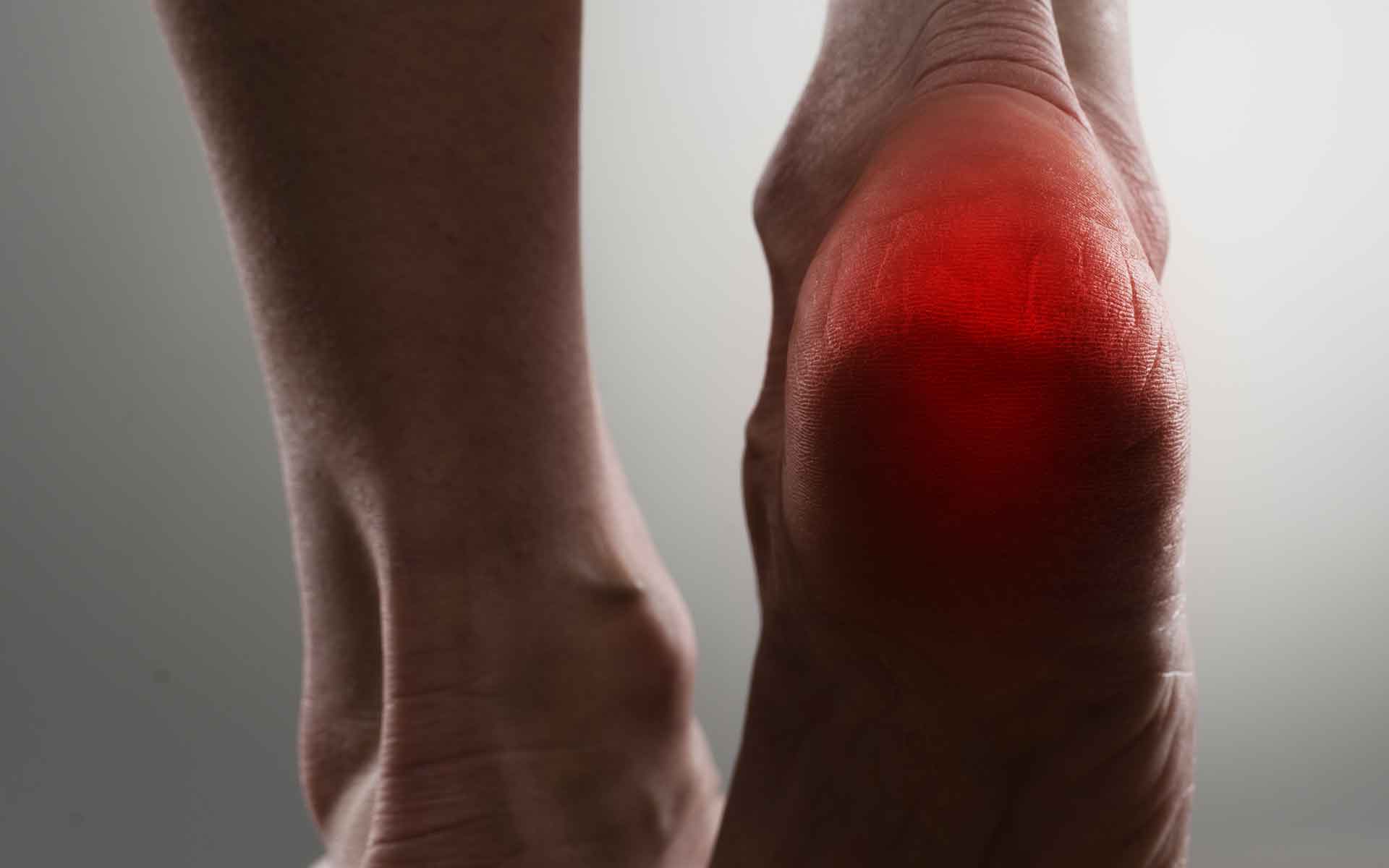 Fascitis Plantar 👉 Calzado, Tratamiento y Ejercicios para el Dolor del  Talón 