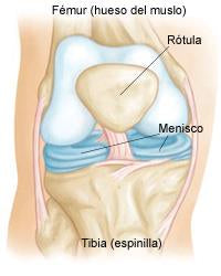 menisco rodilla