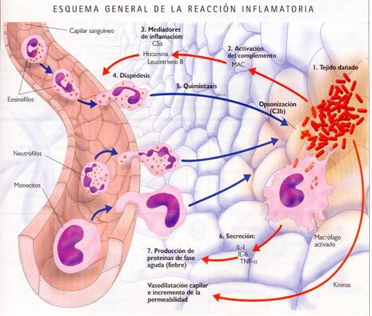 inflamacion fascitis plantar