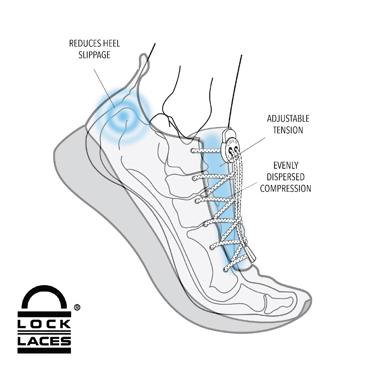 elastic shoe laces athlete's foot