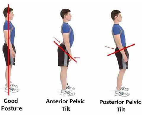 Pelvic Tilt and Squats: Butt Winking and Posterior Pelvic Tilt - [P]rehab