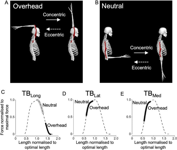 triceps activation for overhead vs elbow at side emg