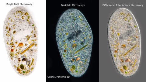 Ciliate Frontonia sp viewed with three different forms of microscopy. Frontonia are closely related to members of the genus Paramecium. Diatoms and other algae can be seen inside the cell.