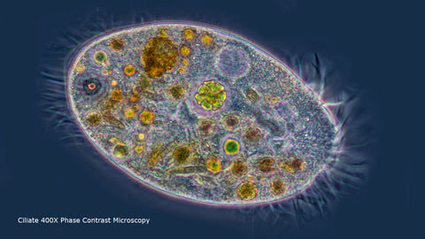 Ciliate viewed by phase contrast microscopy