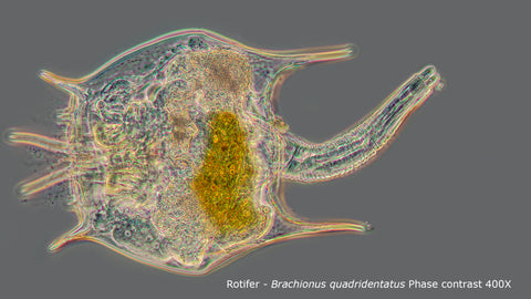 Rotifer Brachionus quadridentatus Phase contrast microscopy 400X